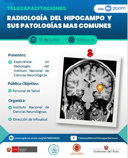 "RADIOLOGÍA DEL HIPOCAMPO Y SUS PATOLOGÍAS MAS COMUNES"